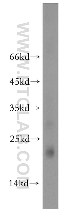 RNF125 Rabbit anti-Human, Mouse, Rat, Polyclonal, Proteintech:Antibodies:Primary