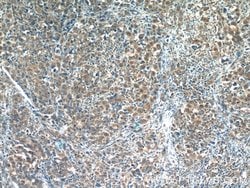 RNF125 Rabbit anti-Human, Mouse, Rat, Polyclonal, Proteintech:Antibodies:Primary
