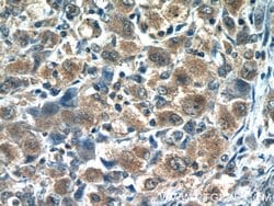 RNF125 Rabbit anti-Human, Mouse, Rat, Polyclonal, Proteintech:Antibodies:Primary