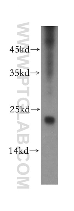 RNF125 Rabbit anti-Human, Mouse, Rat, Polyclonal, Proteintech:Antibodies:Primary