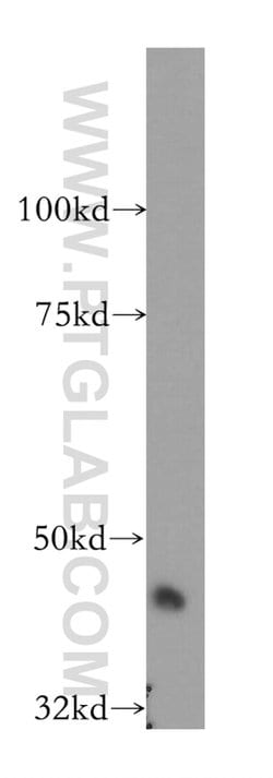 SERPINI2 Rabbit anti-Human, Mouse, Rat, Polyclonal, Proteintech 150 &mu;L;
