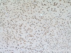 CLSTN3 Rabbit anti-Human, Mouse, Porcine, Rat, Polyclonal, Proteintech