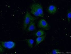 VASH2 Rabbit anti-Human, Mouse, Rat, Polyclonal, Proteintech:Antibodies:Primary
