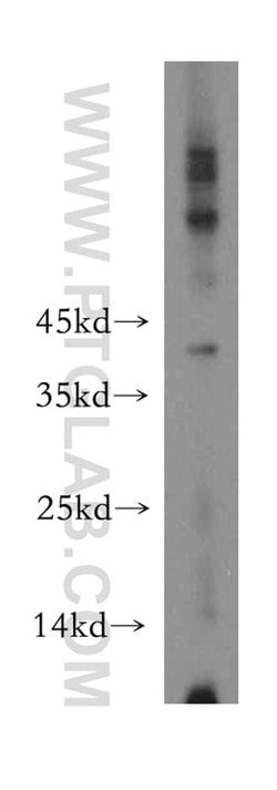 VASH2 Rabbit anti-Human, Mouse, Rat, Polyclonal, Proteintech:Antibodies:Primary