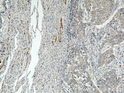 P-selectin Rabbit anti-Human, Polyclonal, Proteintech:Antibodies:Primary