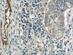 P-selectin Rabbit anti-Human, Polyclonal, Proteintech:Antibodies:Primary