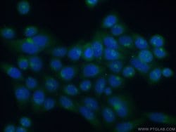 ATP2C1 Rabbit anti-Human, Mouse, Rat, Polyclonal, Proteintech 150 &mu;L;