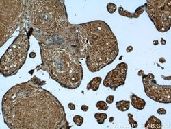 PPBP/NAP2 Rabbit anti-Human, Mouse, Polyclonal, Proteintech:Anticuerpos:Anticuerpos