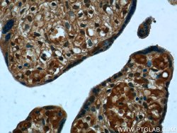PPBP/NAP2 Rabbit anti-Human, Mouse, Polyclonal, Proteintech:Anticuerpos:Anticuerpos