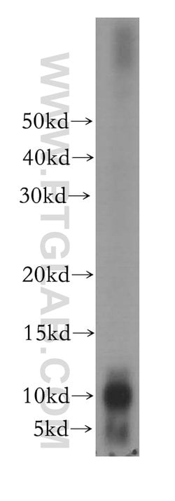 PPBP/NAP2 Rabbit anti-Human, Mouse, Polyclonal, Proteintech:Anticuerpos:Anticuerpos