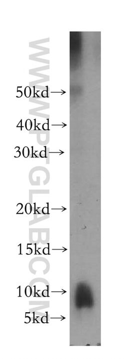 PPBP/NAP2 Rabbit anti-Human, Mouse, Polyclonal, Proteintech:Anticuerpos:Anticuerpos