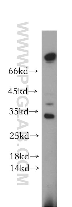 STOML3 Rabbit anti-Human, Mouse, Rat, Polyclonal, Proteintech:Antibodies:Primary