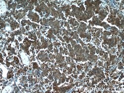 Cytoglobin Rabbit anti-Human, Mouse, Rat, Polyclonal, Proteintech 150 &mu;L;