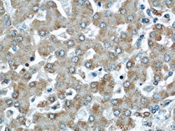 Cytoglobin Rabbit anti-Human, Mouse, Rat, Polyclonal, Proteintech 150 &mu;L;