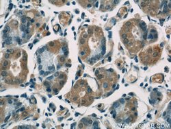 Cytoglobin Rabbit anti-Human, Mouse, Rat, Polyclonal, Proteintech 150 &mu;L;