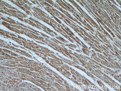 Cytoglobin Rabbit anti-Human, Mouse, Rat, Polyclonal, Proteintech 150 &mu;L;