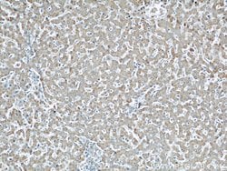 Cytoglobin Rabbit anti-Human, Mouse, Rat, Polyclonal, Proteintech 150 &mu;L;