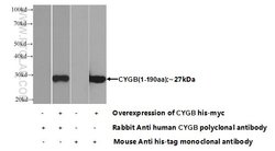 Cytoglobin Rabbit anti-Human, Mouse, Rat, Polyclonal, Proteintech 150 &mu;L;