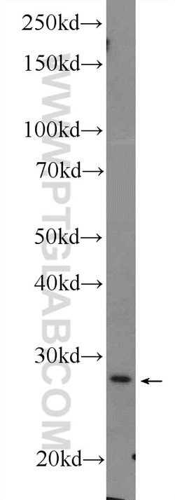 Cytoglobin Rabbit anti-Human, Mouse, Rat, Polyclonal, Proteintech 150 &mu;L;