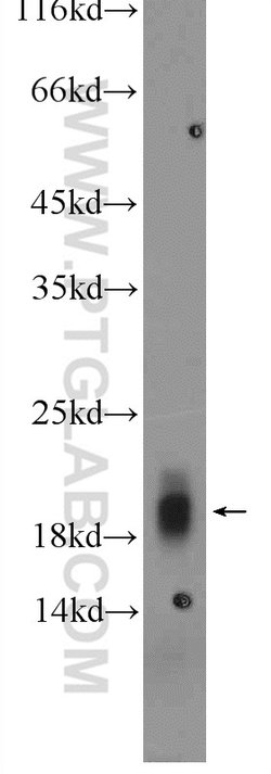 Cytoglobin Rabbit anti-Human, Mouse, Rat, Polyclonal, Proteintech 150 &mu;L;