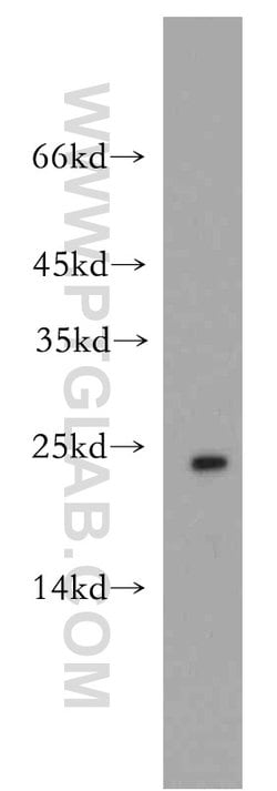 Cytoglobin Rabbit anti-Human, Mouse, Rat, Polyclonal, Proteintech 150 &mu;L;