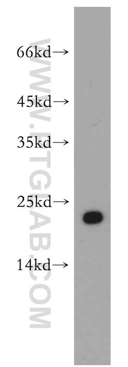 Cytoglobin Rabbit anti-Human, Mouse, Rat, Polyclonal, Proteintech 150 &mu;L;