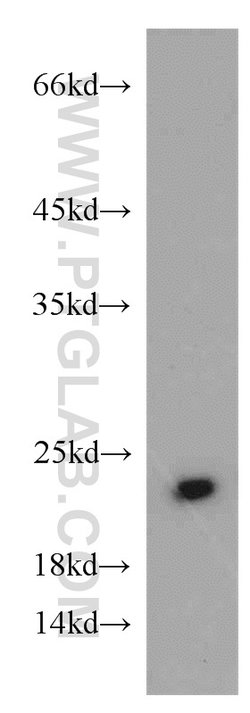 Cytoglobin Rabbit anti-Human, Mouse, Rat, Polyclonal, Proteintech 150 &mu;L;