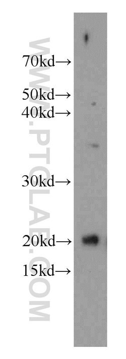 Cytoglobin Rabbit anti-Human, Mouse, Rat, Polyclonal, Proteintech 150 &mu;L;