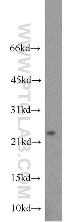 Cytoglobin Rabbit anti-Human, Mouse, Rat, Polyclonal, Proteintech 150 &mu;L;
