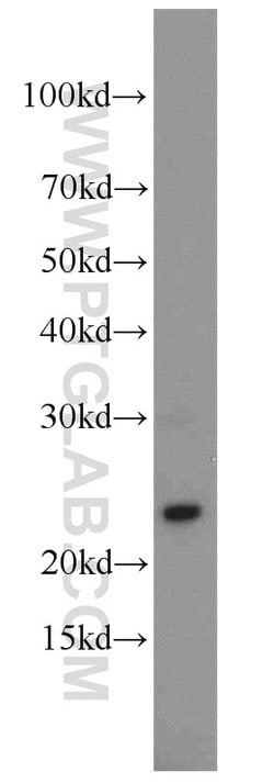 Cytoglobin Rabbit anti-Human, Mouse, Rat, Polyclonal, Proteintech 150 &mu;L;