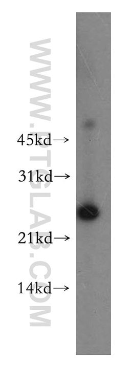 Cytoglobin Rabbit anti-Human, Mouse, Rat, Polyclonal, Proteintech 150 &mu;L;