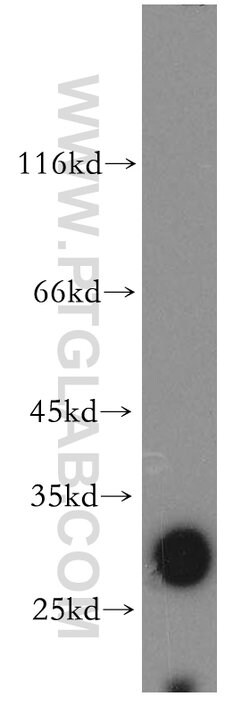 SLC17A5 Rabbit anti-Human, Mouse, Rat, Polyclonal, Proteintech:Antibodies:Primary