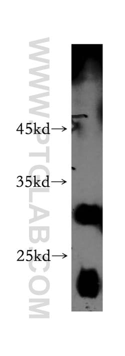 SLC17A5 Rabbit anti-Human, Mouse, Rat, Polyclonal, Proteintech:Antibodies:Primary