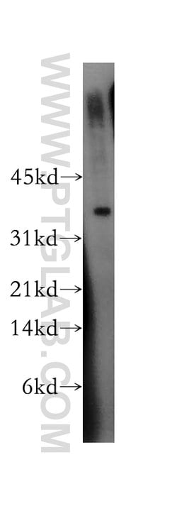 TSG-6 Rabbit anti-Human, Mouse, Rat, Polyclonal, Proteintech 150 &mu;L;