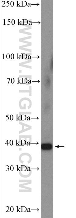 TSG-6 Rabbit anti-Human, Mouse, Rat, Polyclonal, Proteintech 150 &mu;L;