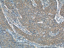 ADA Rabbit anti-Human, Mouse, Polyclonal, Proteintech:Anticorps:Anticorps
