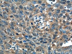 ADA Rabbit anti-Human, Mouse, Polyclonal, Proteintech:Anticorps:Anticorps