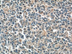 ADA Rabbit anti-Human, Mouse, Polyclonal, Proteintech:Anticorps:Anticorps