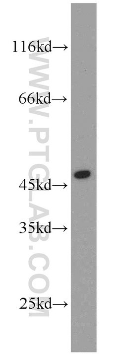 ADA Rabbit anti-Human, Mouse, Polyclonal, Proteintech:Anticorps:Anticorps