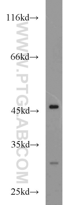 ADA Rabbit anti-Human, Mouse, Polyclonal, Proteintech:Anticorps:Anticorps