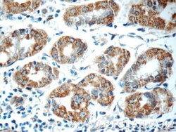 ADA Rabbit anti-Human, Mouse, Polyclonal, Proteintech:Anticorps:Anticorps