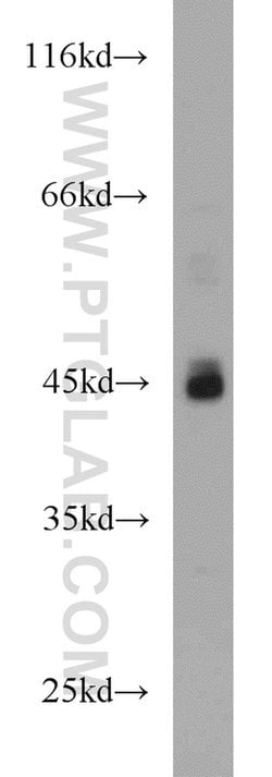 ADA Rabbit anti-Human, Mouse, Polyclonal, Proteintech:Anticorps:Anticorps