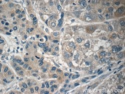 PI3K p101 Rabbit anti-Human, Mouse, Rat, Polyclonal, Proteintech:Antibodies:Primary
