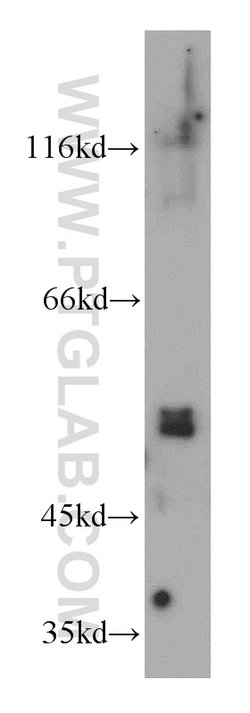 PI3K p101 Rabbit anti-Human, Mouse, Rat, Polyclonal, Proteintech:Antibodies:Primary