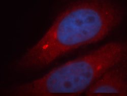 PI3K p101 Rabbit anti-Human, Mouse, Rat, Polyclonal, Proteintech:Antibodies:Primary