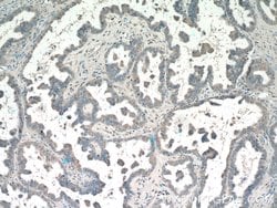 PI3K p101 Rabbit anti-Human, Mouse, Rat, Polyclonal, Proteintech:Antibodies:Primary