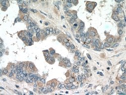 PI3K p101 Rabbit anti-Human, Mouse, Rat, Polyclonal, Proteintech:Antibodies:Primary