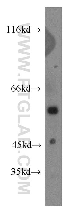 PI3K p101 Rabbit anti-Human, Mouse, Rat, Polyclonal, Proteintech:Antibodies:Primary