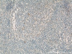 CD94 Rabbit anti-Human, Polyclonal, Proteintech:Antibodies:Primary Antibodies