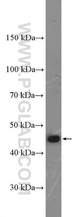 CD94 Rabbit anti-Human, Polyclonal, Proteintech:Antibodies:Primary Antibodies